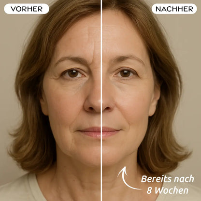 LED Lichttherapie Maske