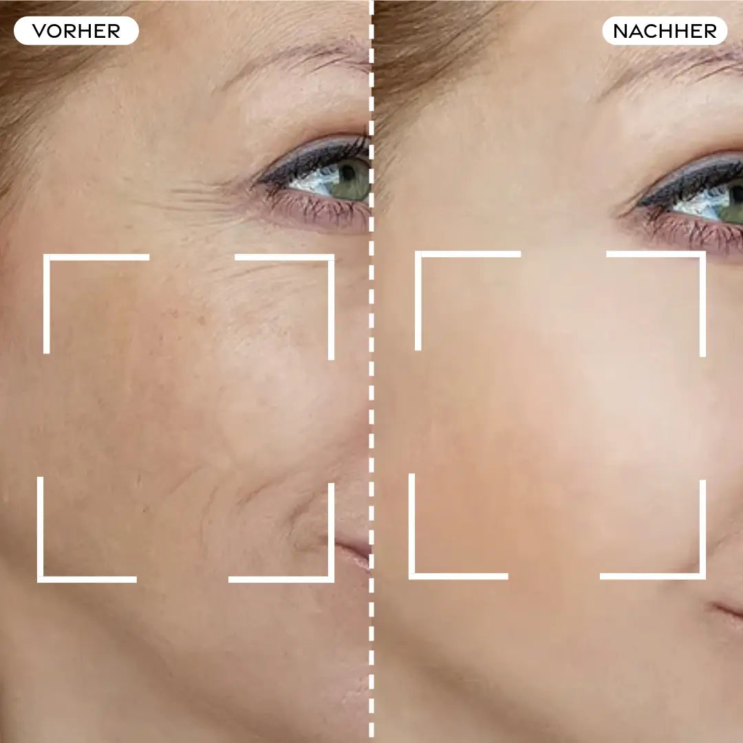 Before/After Comparison
