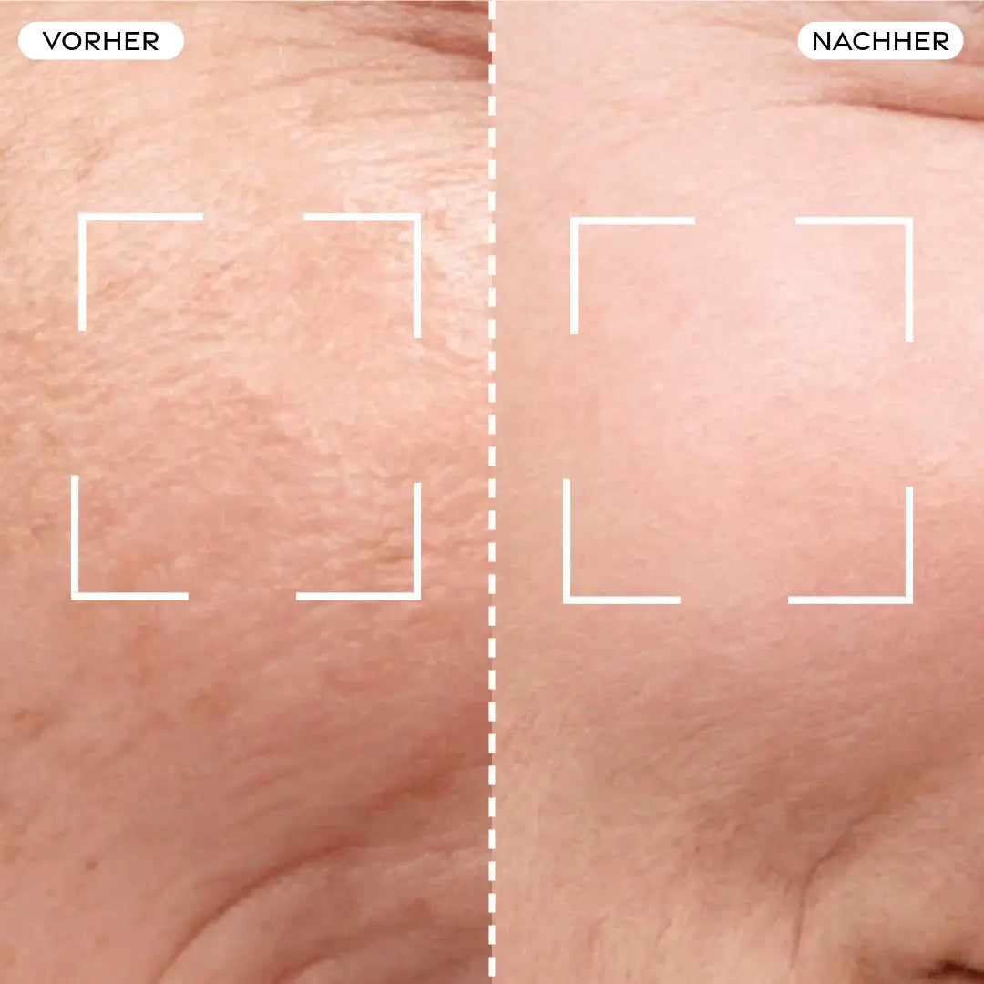 Before/After Comparison