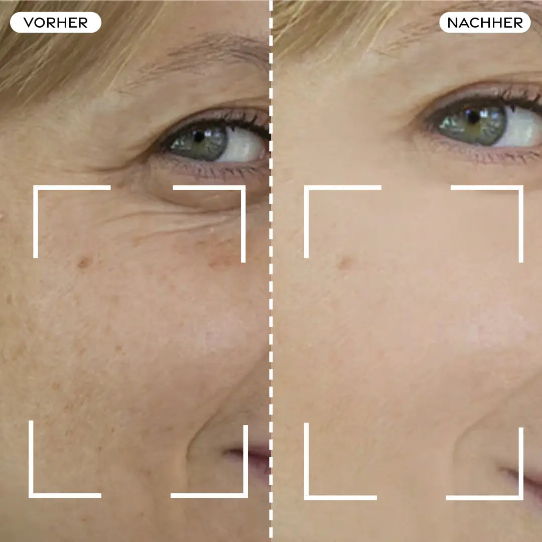 Before/After Comparison