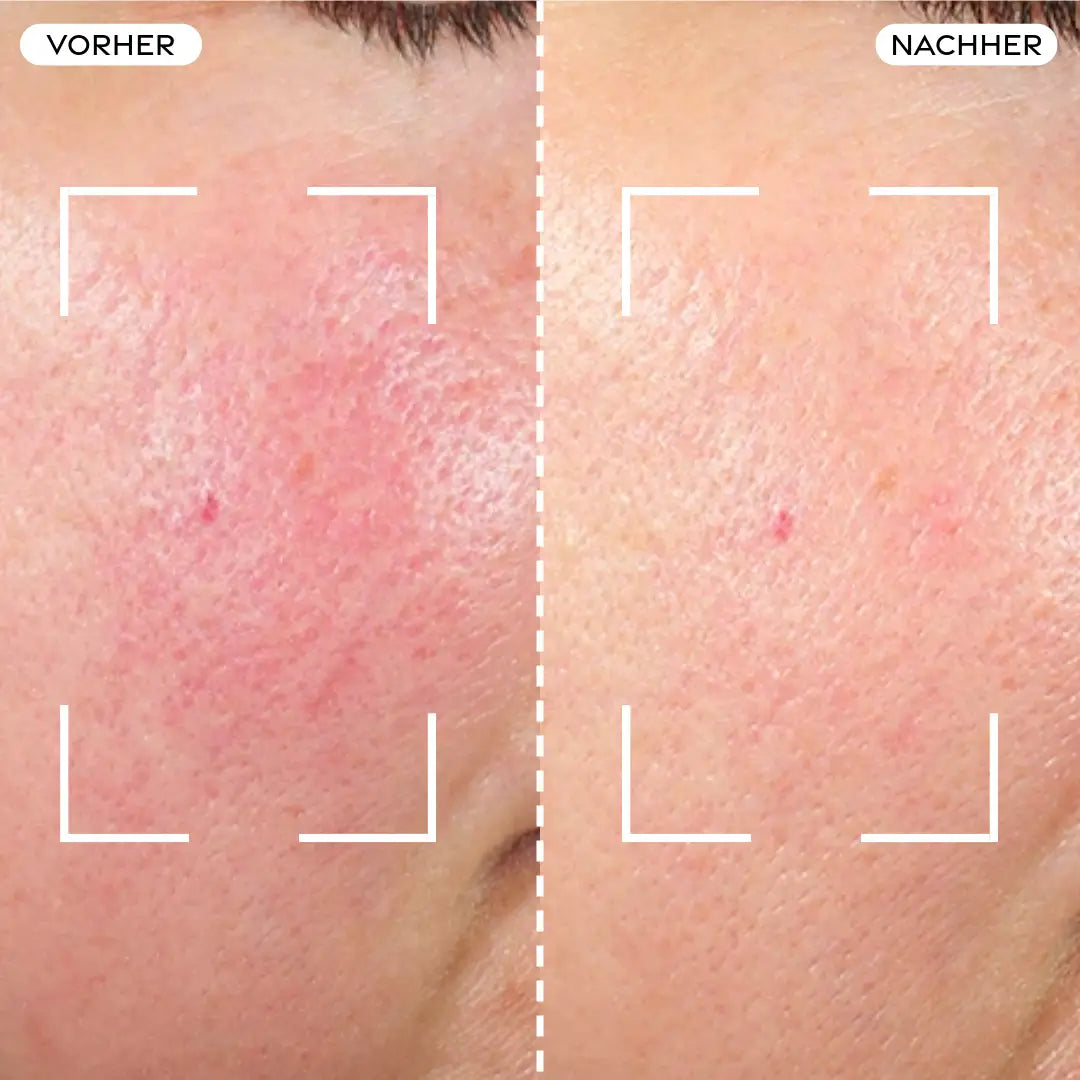 Before/After Comparison